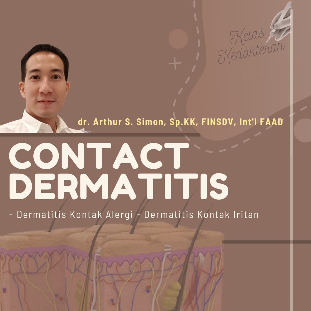 Manajemen Dermatitis Kontak Alergi & Dermatitis Kontak Iritan